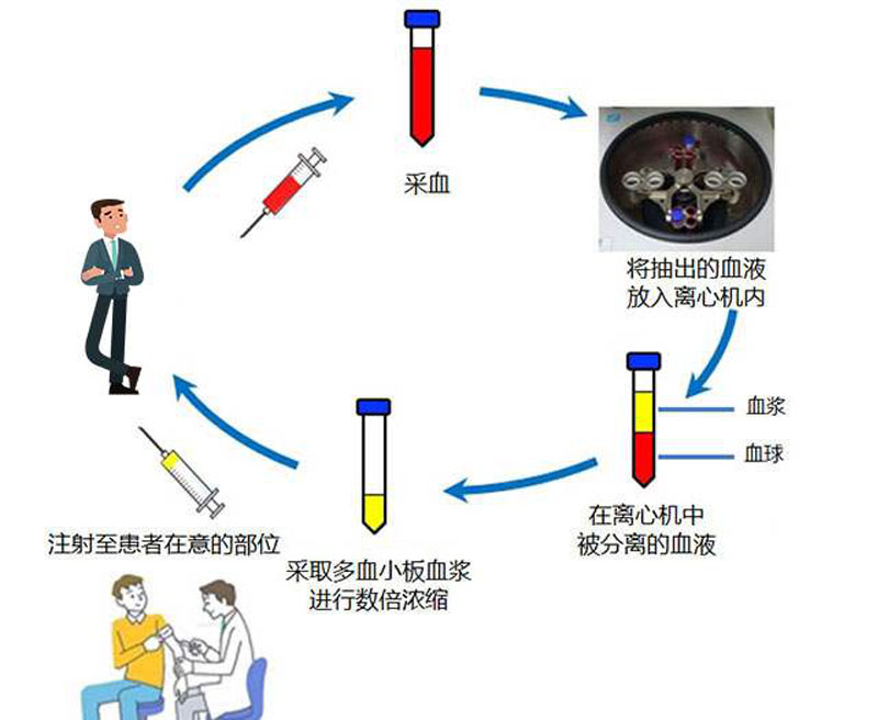 自体脂肪干细胞存储